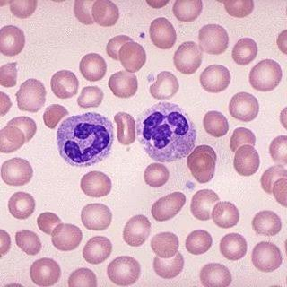 <p>40-45% of volume is cells, fibrous proteins for clotting, mostly fluid<br>functions: transportation of gases, nutrients, wastes, and hormones<br>locations:<br>cardiovascular system </p>