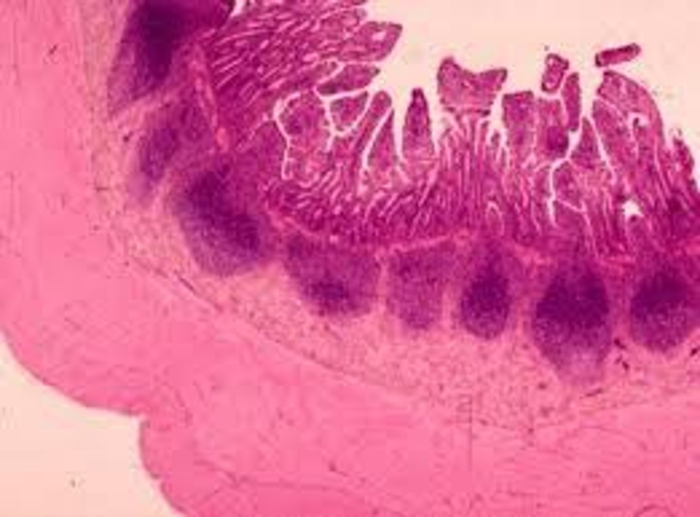 <p>What is this a picture of? Where is it found in the body?</p>