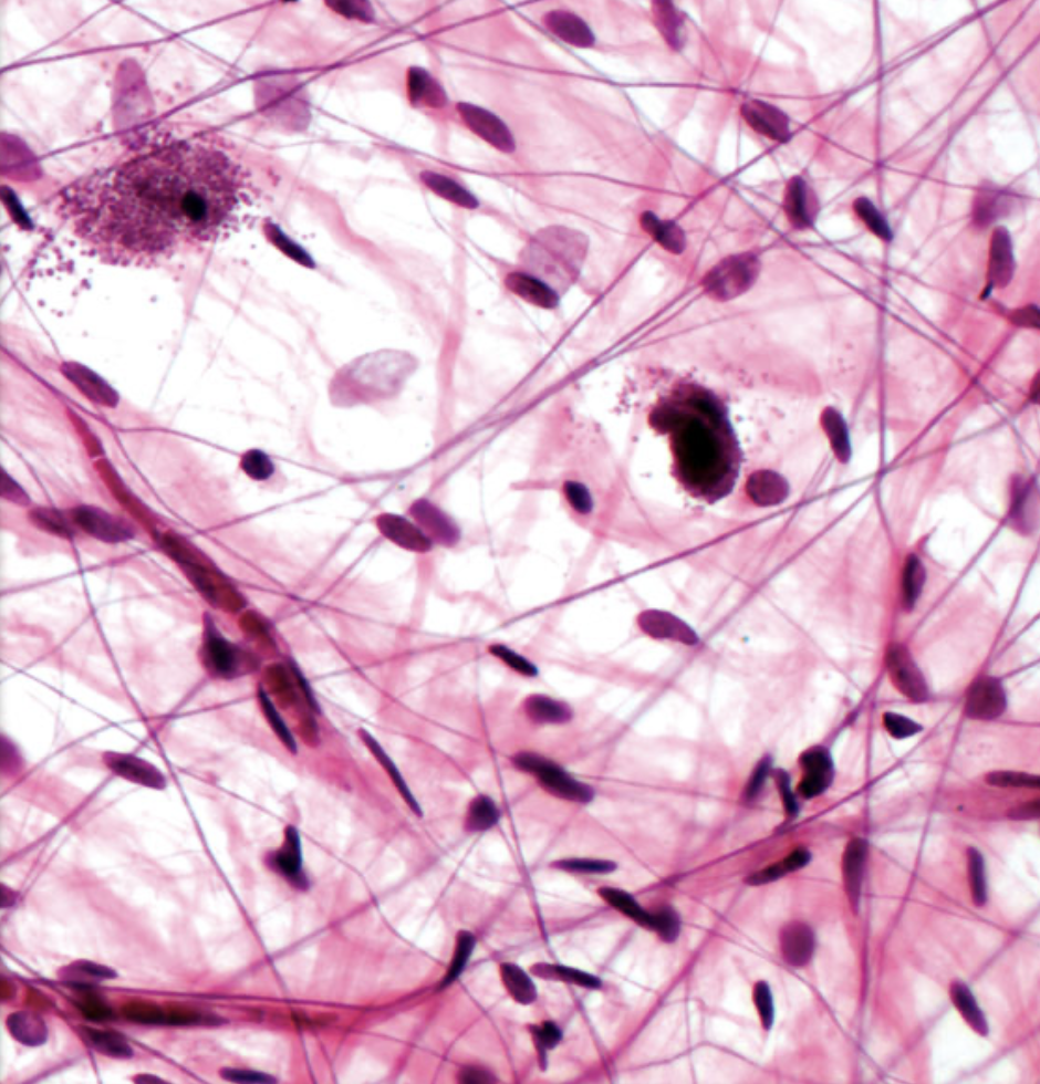 <p>tissue type </p>