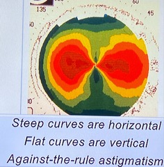 <p>The horizontal meridian has the steepest curvature</p>