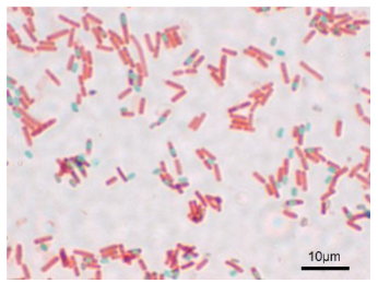 <p>What kind of stain?</p>