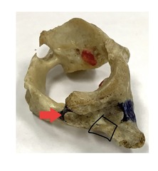 <p>what is marked? (not the arrow)</p>