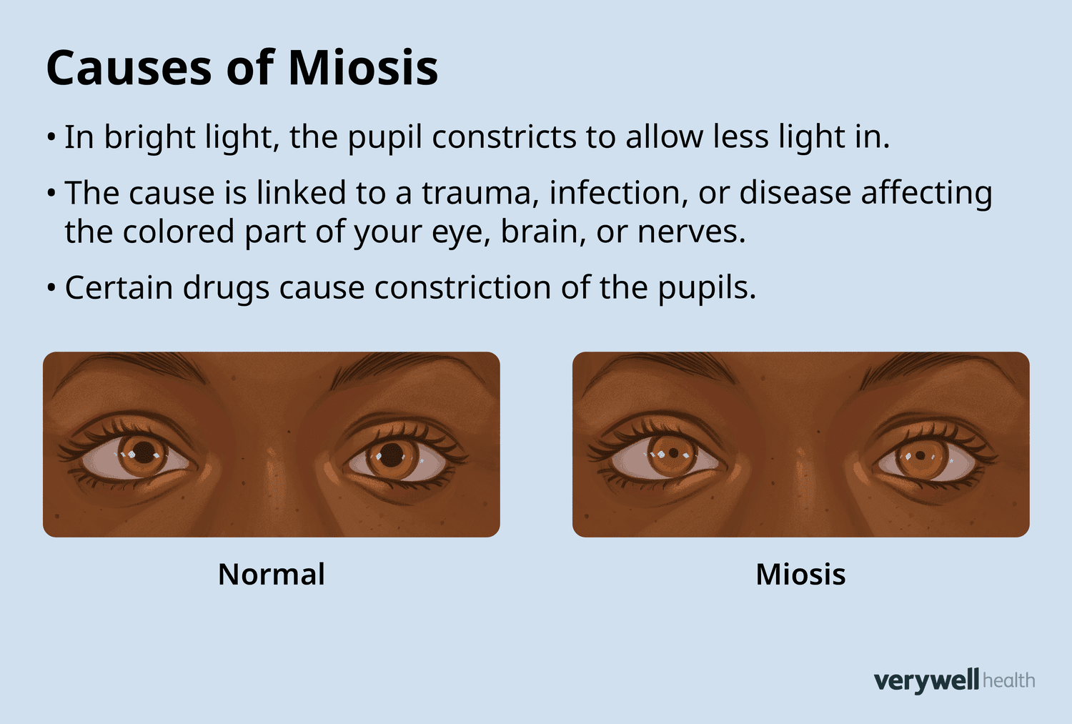 <p>constricted pupils</p>