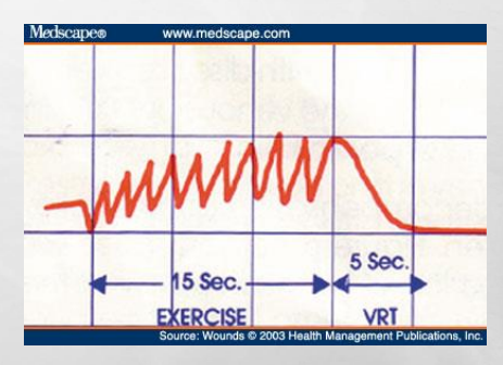 <p>is the normal or abnormal</p>