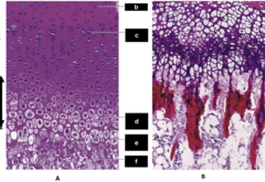 <p>growth plate, e: zone</p>