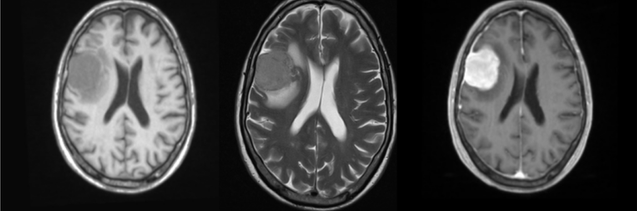 <p>Which is which </p>