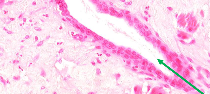 <p>soort epitheel</p>