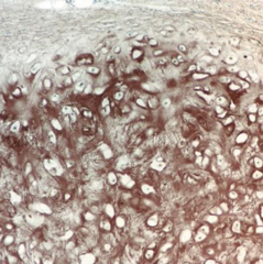 <p>What type of cartilage is shown?</p>