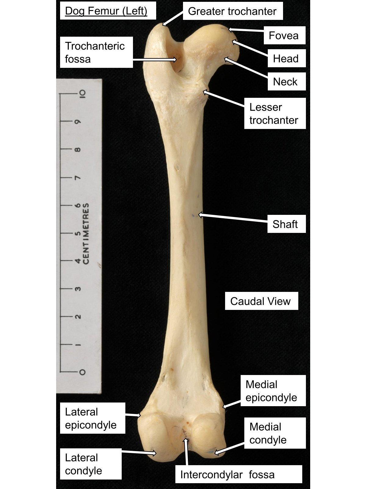 <p>ridge of bone that forms caudolateral border of the fossa is the intertrochanteric crest </p>