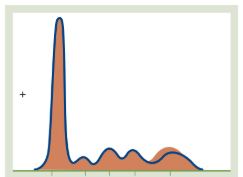 <ul><li><p><span style="background-color: transparent; font-family: "Times New Roman", serif;">The Pattern: A broad, </span><span style="font-family: "Times New Roman", serif;">"mountain-like" rise in the Gamma region</span><span style="background-color: transparent; font-family: "Times New Roman", serif;">.</span></p></li><li><p><span style="background-color: transparent; font-family: "Times New Roman", serif;">Why: Unlike the narrow spike in (E), this shows </span><span style="font-family: "Times New Roman", serif;">many different plasma cells are active</span><span style="background-color: transparent; font-family: "Times New Roman", serif;">. This is common in </span><span style="font-family: "Times New Roman", serif;">chronic infections</span><span style="background-color: transparent; font-family: "Times New Roman", serif;">, autoimmune diseases (like Lupus), or chronic liver disease.</span></p></li></ul><p></p>