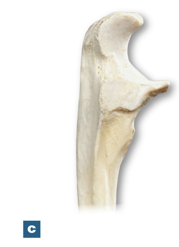 <p>Articulates with trochlea. <strong>(Ulna)</strong></p>