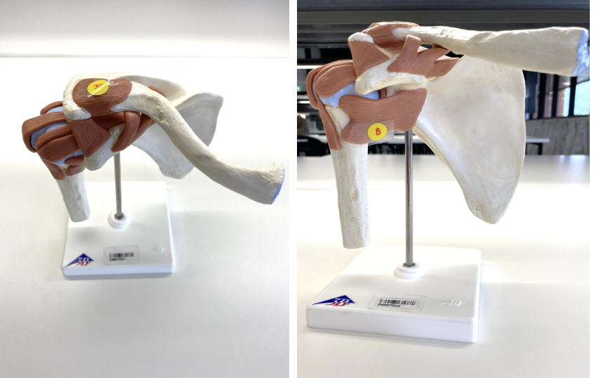 <p>Name the ligaments of the shoulder joint</p>