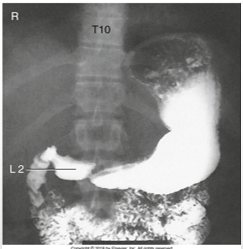 <p>what type of patient is this?</p>