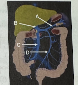 <p>B</p>