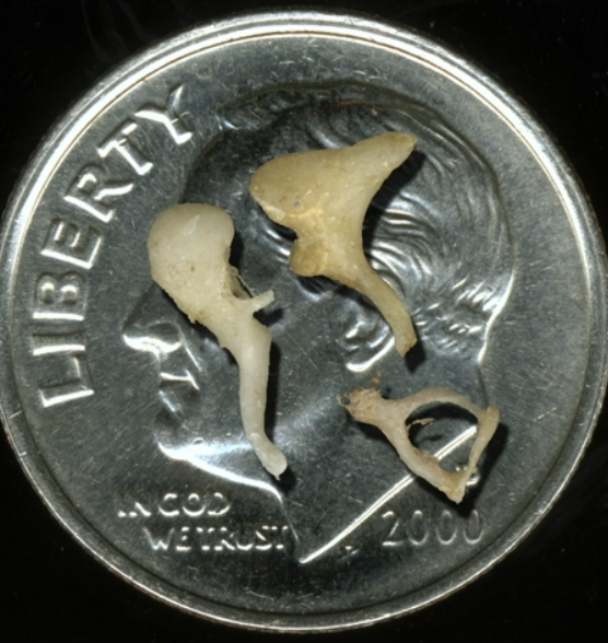 <p>label the three ossicles</p>