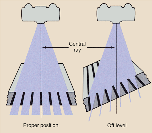 <p>Grid cutoff across image; underexposed, light image</p>
