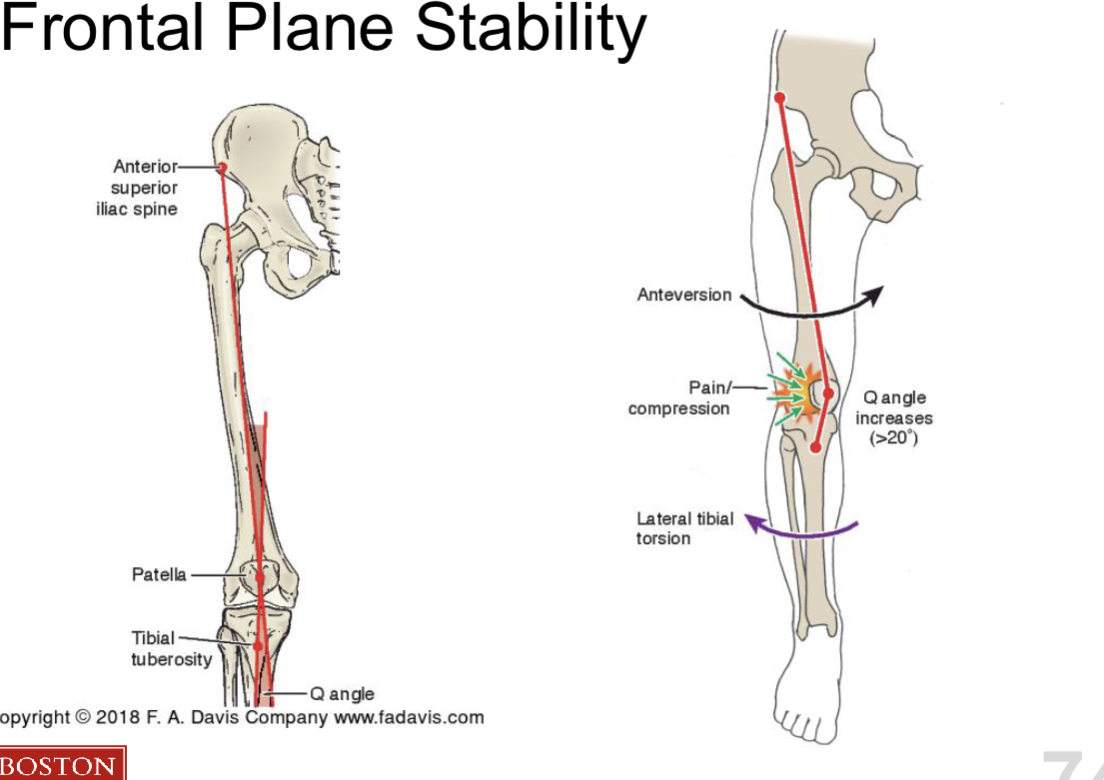 <ul><li><p>line of ASIS → patella </p></li><li><p>line of patella → tibial tuberosity </p></li></ul><p></p><p>Anteversion → lateral tibial torsion → increase Q angle </p><p></p><p>Increase Q angle is NOT indication of PFJ pain</p><p></p>