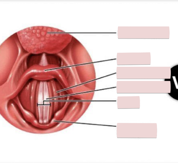 <p>Label the figure</p>