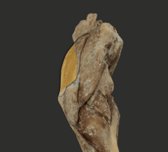 <p>What muscle is highlighted in the picture?</p>