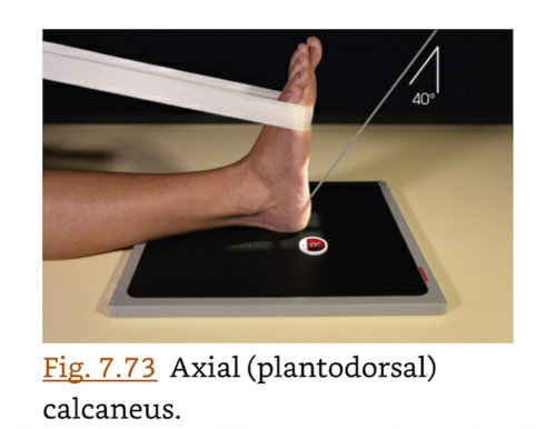 <p>calcaneus</p>