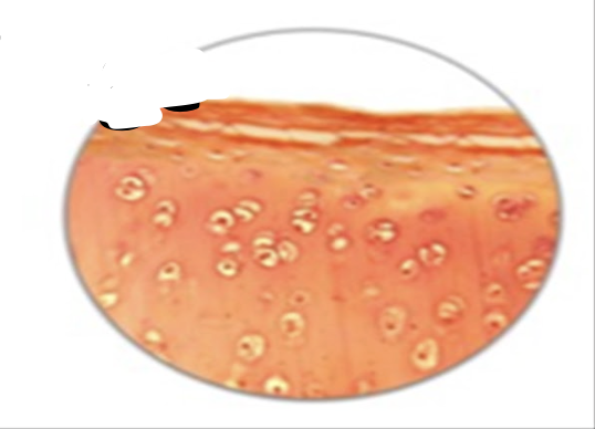 <ul><li><p>no blood vessels or nerves</p></li><li><p>reduces friction between bones</p></li><li><p>stands up against compression and tension very well</p></li><li><p>firm ground substance causes a rigid rubber-like matrix</p></li></ul><p></p>
