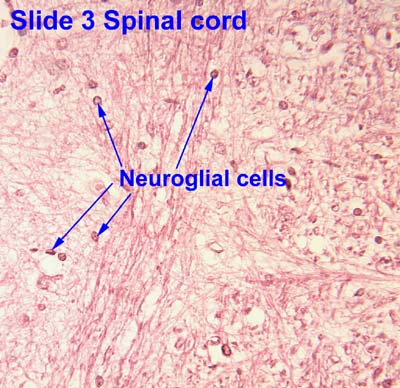 <p>the spinal cord is a cylinder ______ tissue within the spinal _______</p><p>Neurons and ______ cells - very fragile</p>