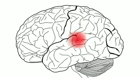 <p>What cortex is this?</p>