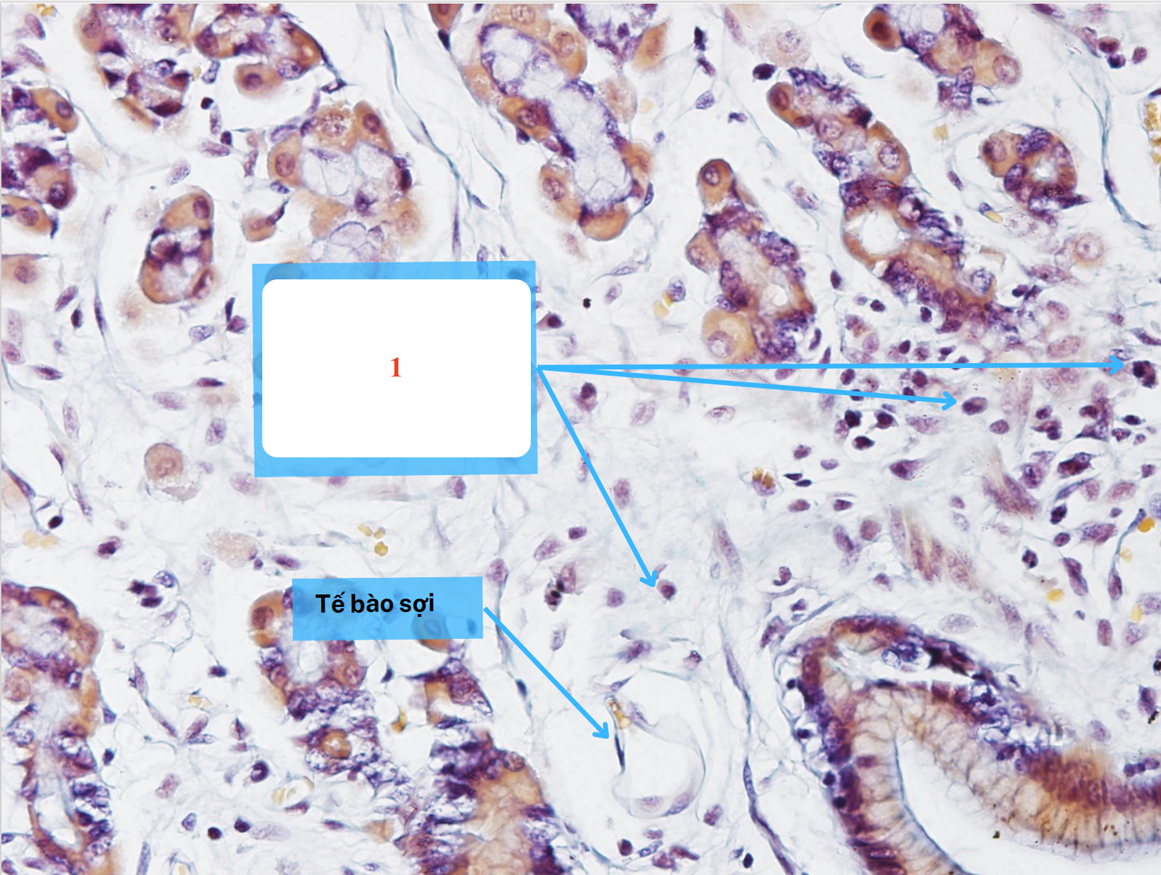 <p>Tế bào gì ?</p>