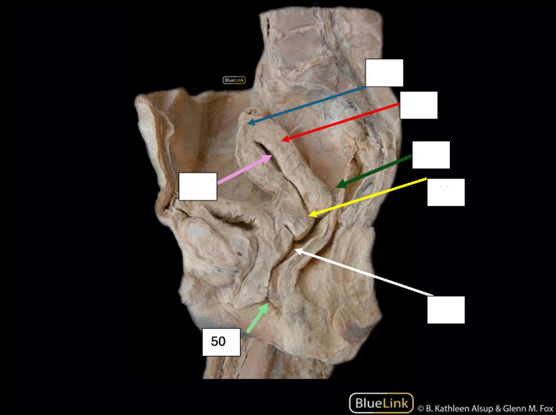 <p>Identify</p><p>Side Question:</p><p>This structure is partially covered by?</p><p>Structures anterior and posterior to this?</p><p>This structure serves as an external opening into?</p><p>The size of this is reduced by which structure?</p>
