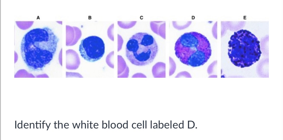 <p>Eosinophil</p><p></p><p>&nbsp;Lymphocyte</p><p>&nbsp;</p><p>Monocyte</p><p>&nbsp;</p><p>Basophi</p>
