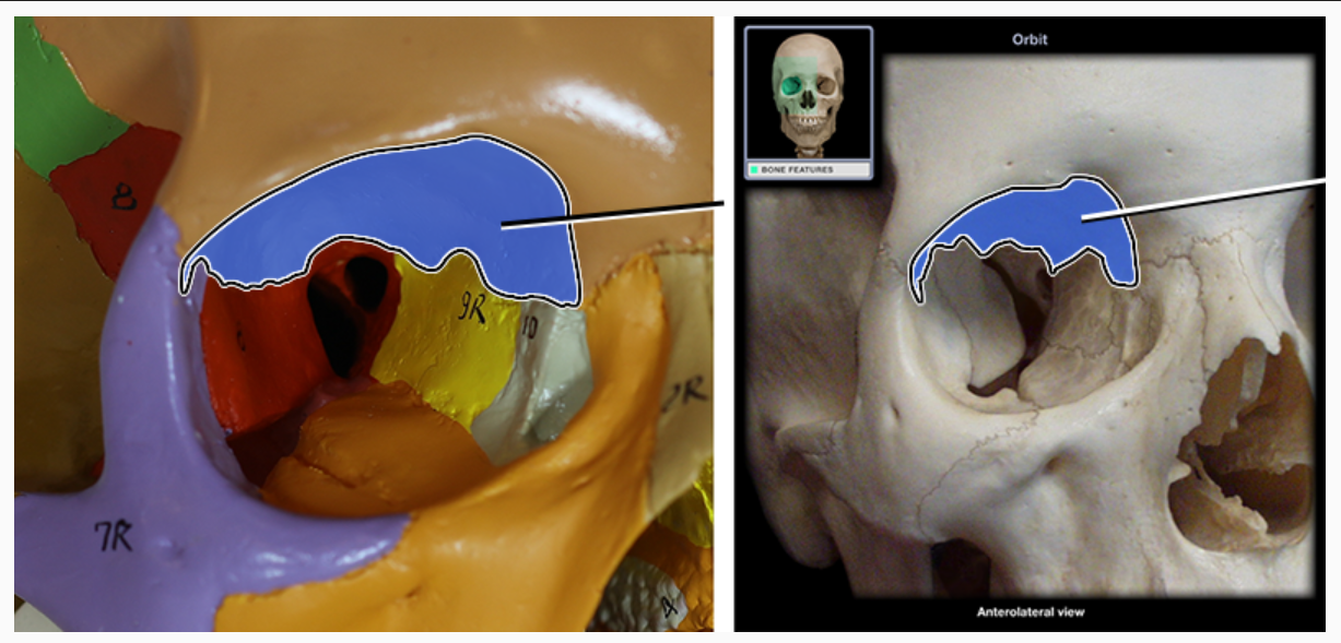 <p>What structure is indicated</p>
