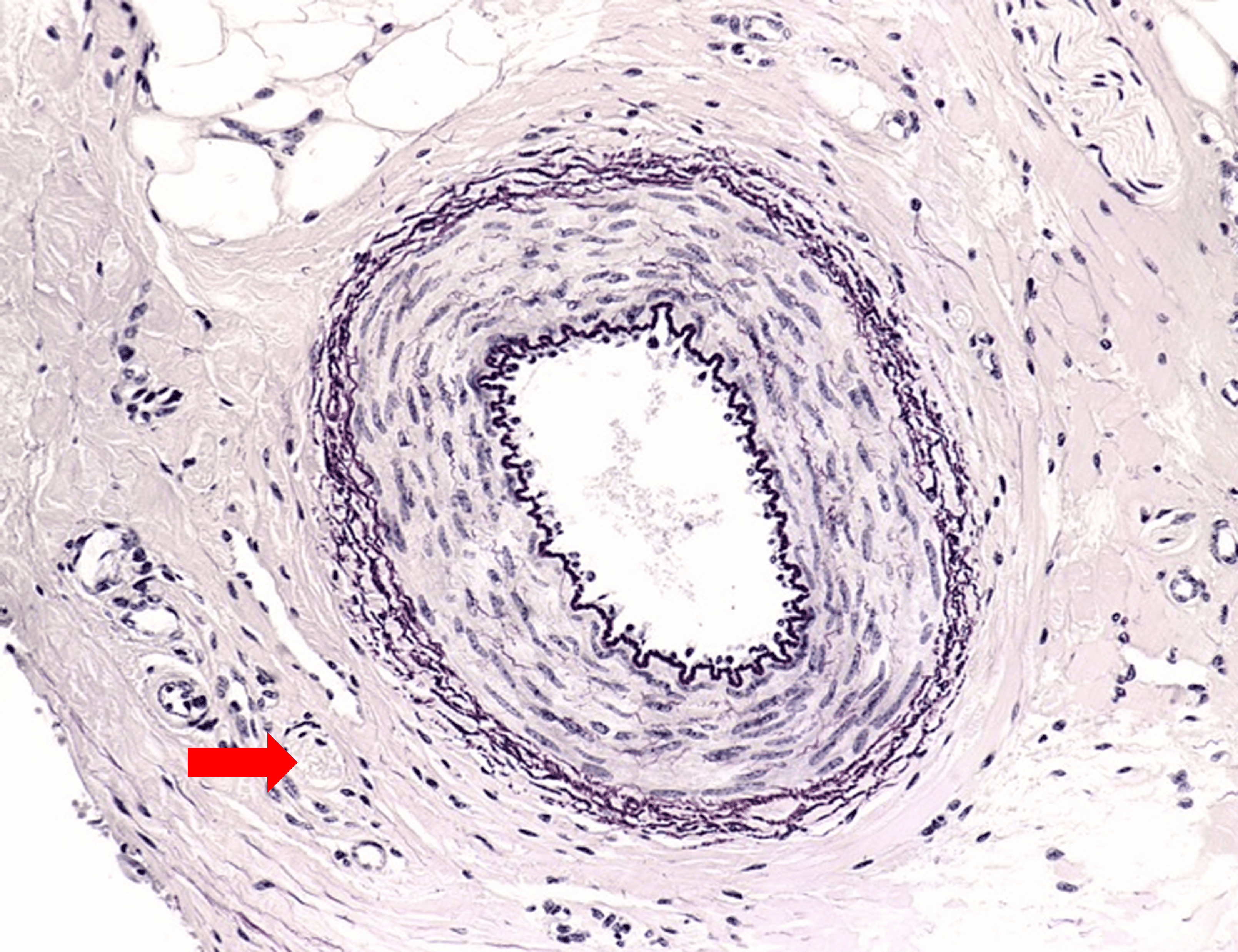 term image