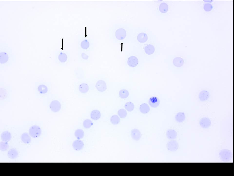 <p><span>The following blood film was most likely stained using</span></p>