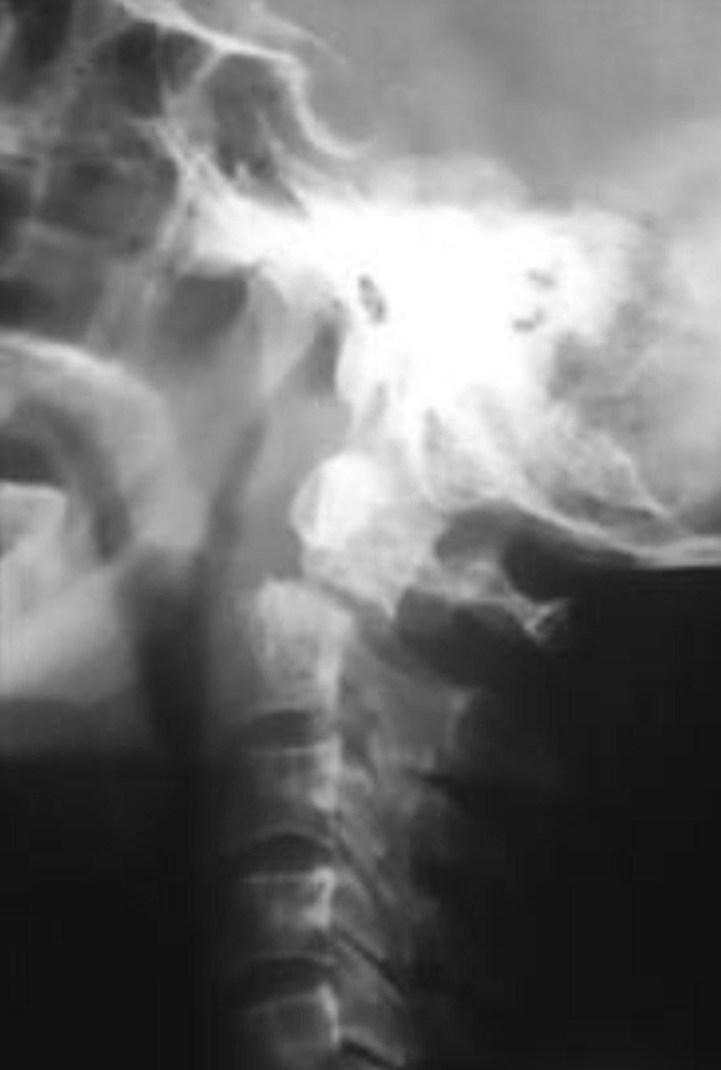 <p>What is the diagnosis?</p>