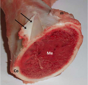 <p>Connective tissue membrane that covers and protects the outer surface of a bone. Richly supplied with blood vessels.</p>