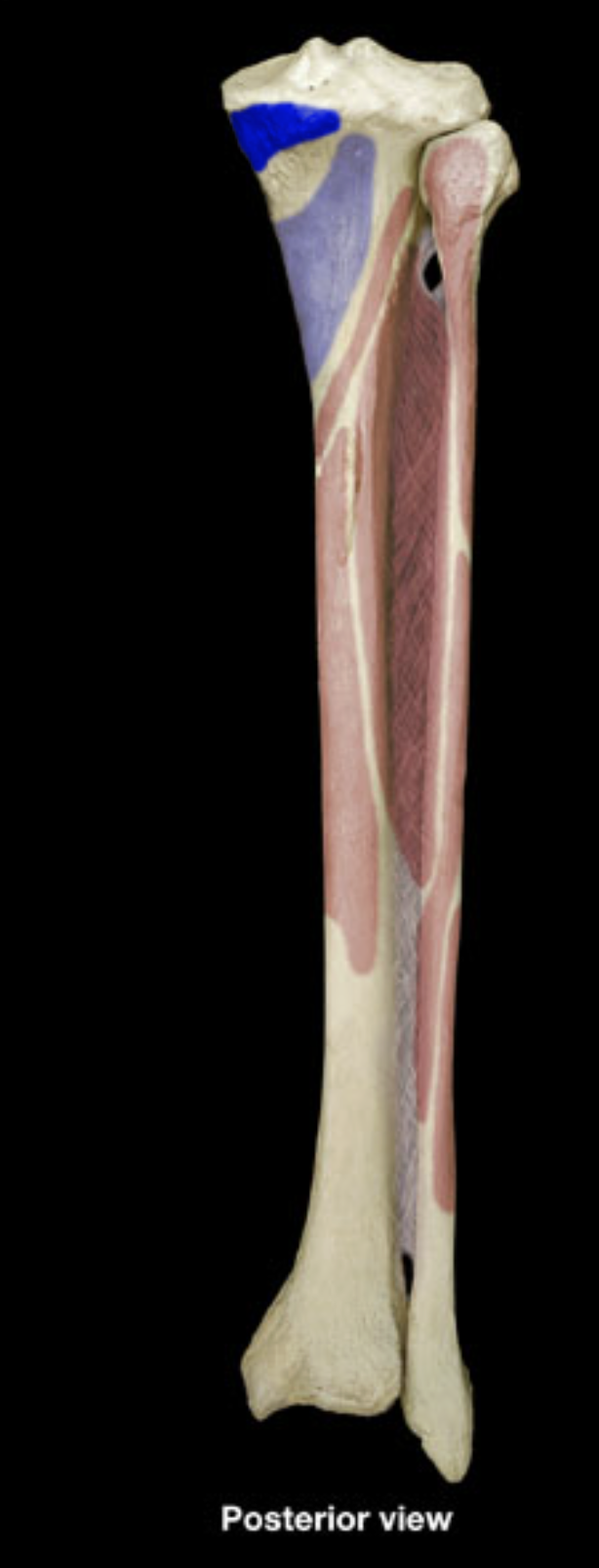 <p>semimembranosus insertion</p>