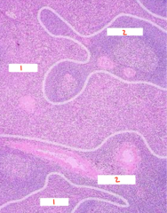 <p>What part of the spleen is labeled 2?</p>