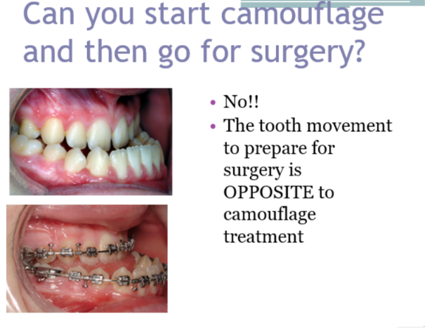 <ul><li><p>decompensate the dentition in pre surgical preparation - wil make a reverse overjet worse before being corrected with surgery</p></li><li><p>camouflage is compensating </p></li></ul><p></p>