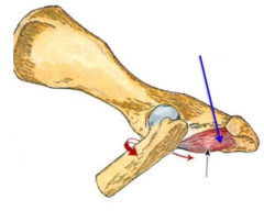 <p>insertion of quadratus femoris</p>
