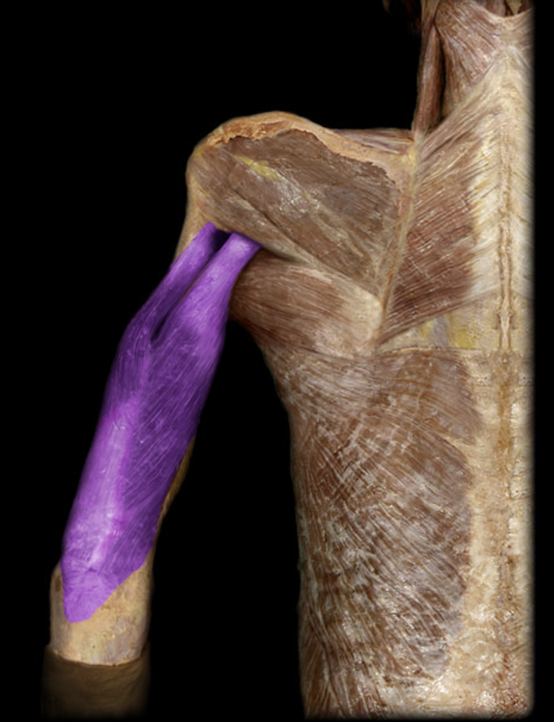 <p>What is the origin of this muscle?</p>