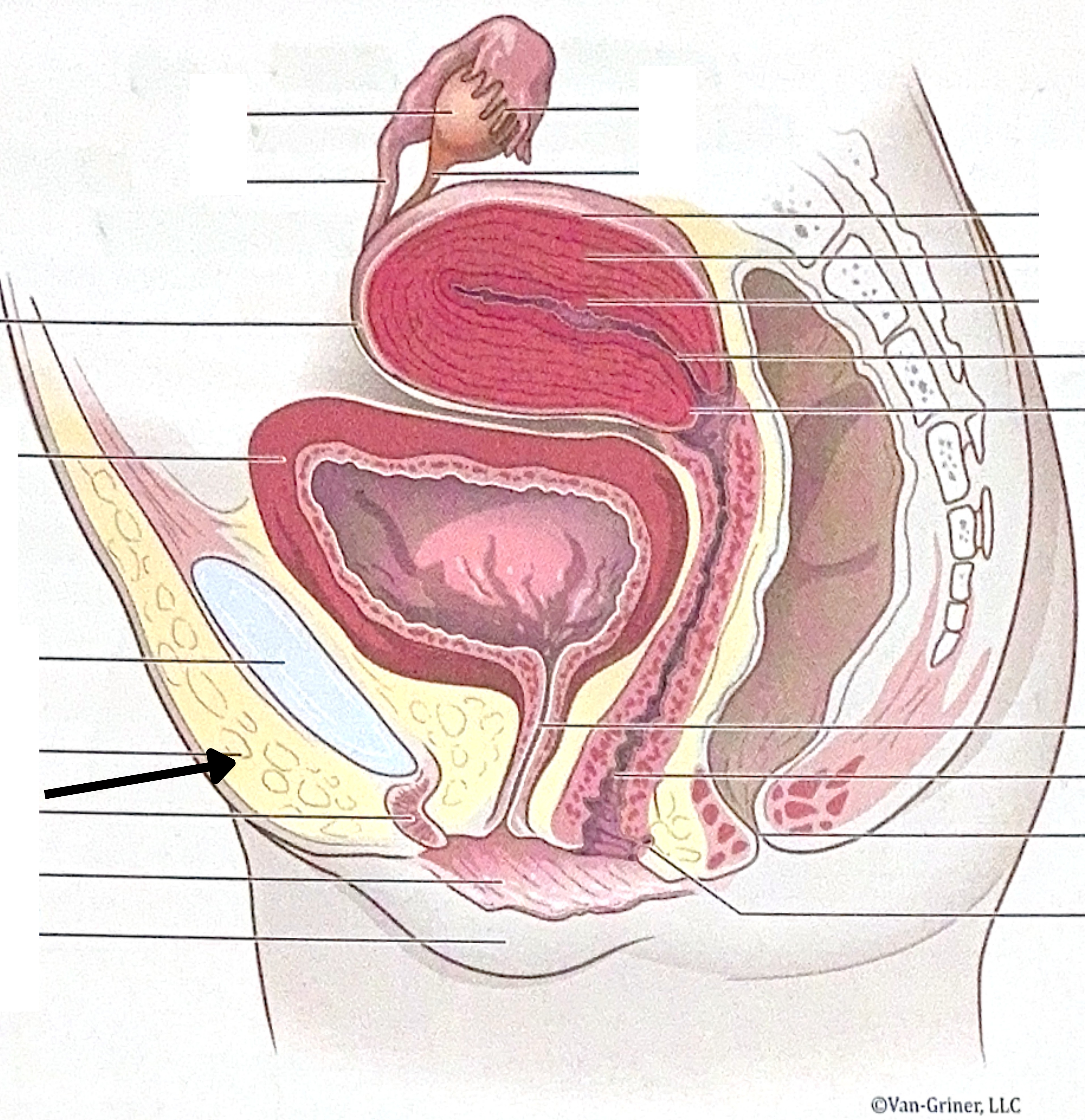 <p>What is the structure indicated in the image?</p>