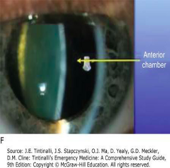 <p>- Provides a magnified view of the eye</p><p>- A thin slit can demonstrate the cornea, iris, and lens</p>