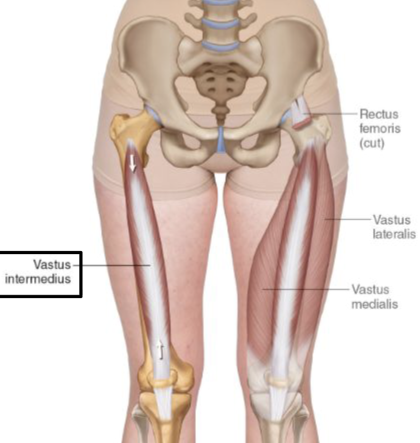 <p>Origin: Anterior and lateral surface of the body of the femur</p><p>Insertion: base of the patella and by patellar ligament to tibial tuberosity</p><p>Action: Extends the leg at the knee joint</p><p>Innervation: Femoral Nerve</p>