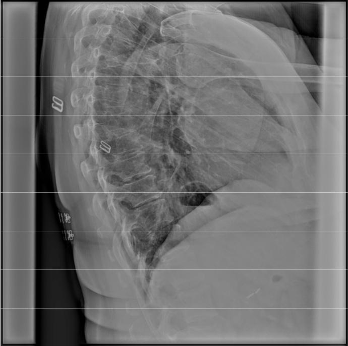 <p>Fix this image (Lateral Thoracic)</p>