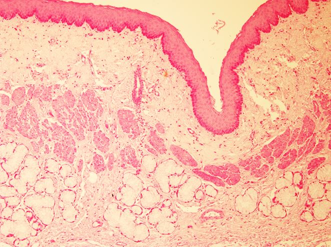 <p>Tiêu bản gì ?</p>