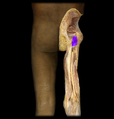 <p>laterally rotates femur at hip joint</p>