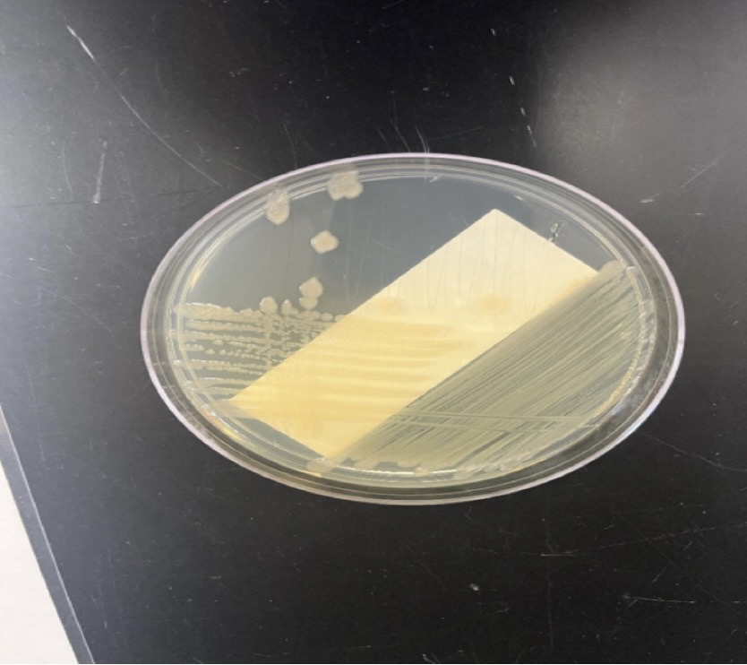 <p>Pseudomonas putida</p>