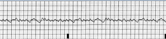<p>what waveform is this</p>