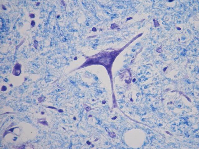 <p><em>Newcomer Supply. (n.d.). Luxol Fast Blue–Cresyl Violet stained nervous tissue [Photomicrograph].</em></p>