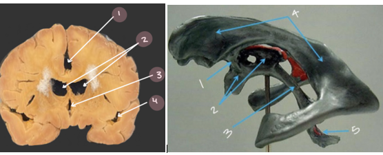 <p>#3 and #2</p>